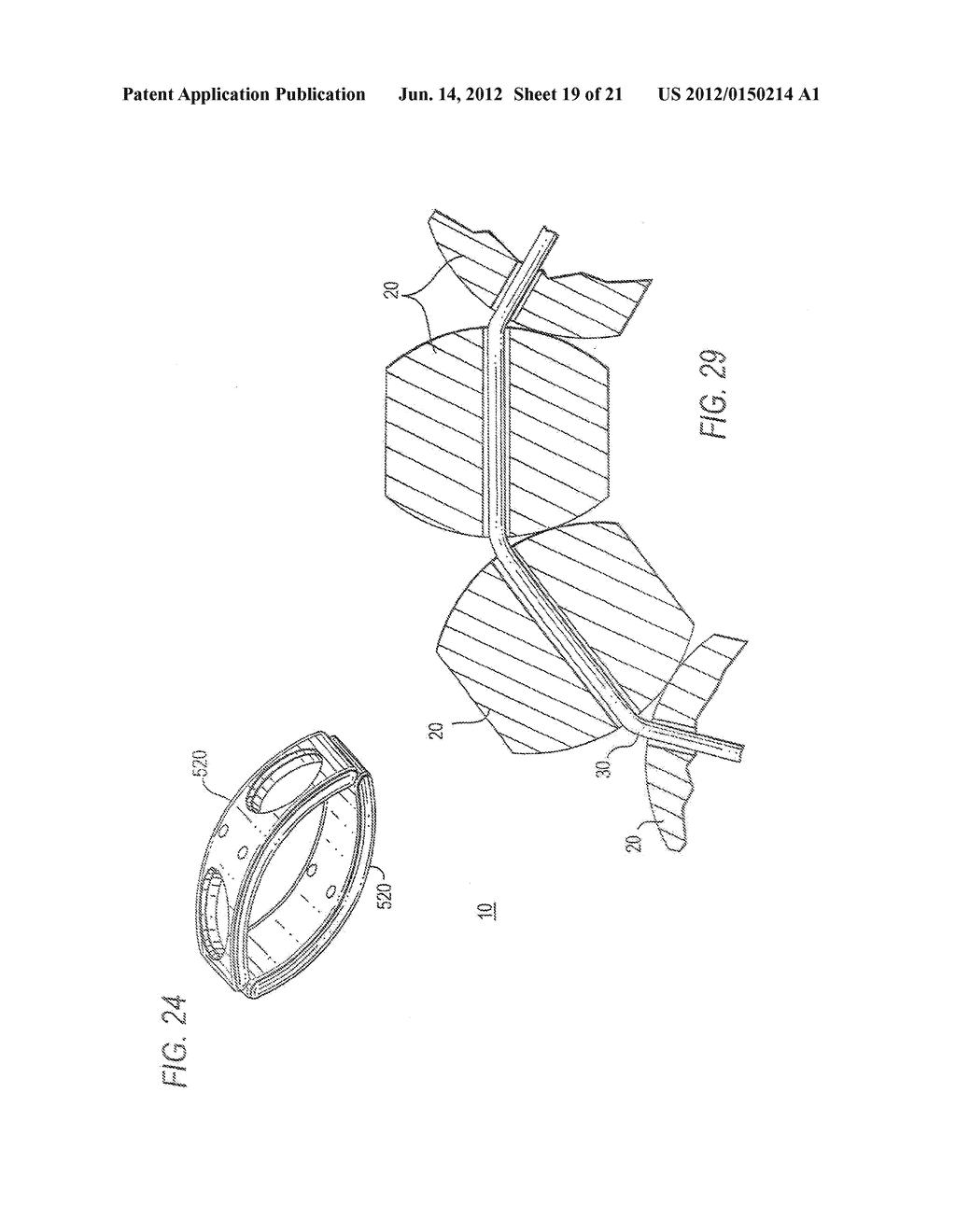 METHODS AND APPARATUS FOR TREATING BODY TISSUE SPHINCTERS AND THE LIKE - diagram, schematic, and image 20