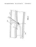 METHOD AND APPARATUS FOR SEALING ACCESS diagram and image