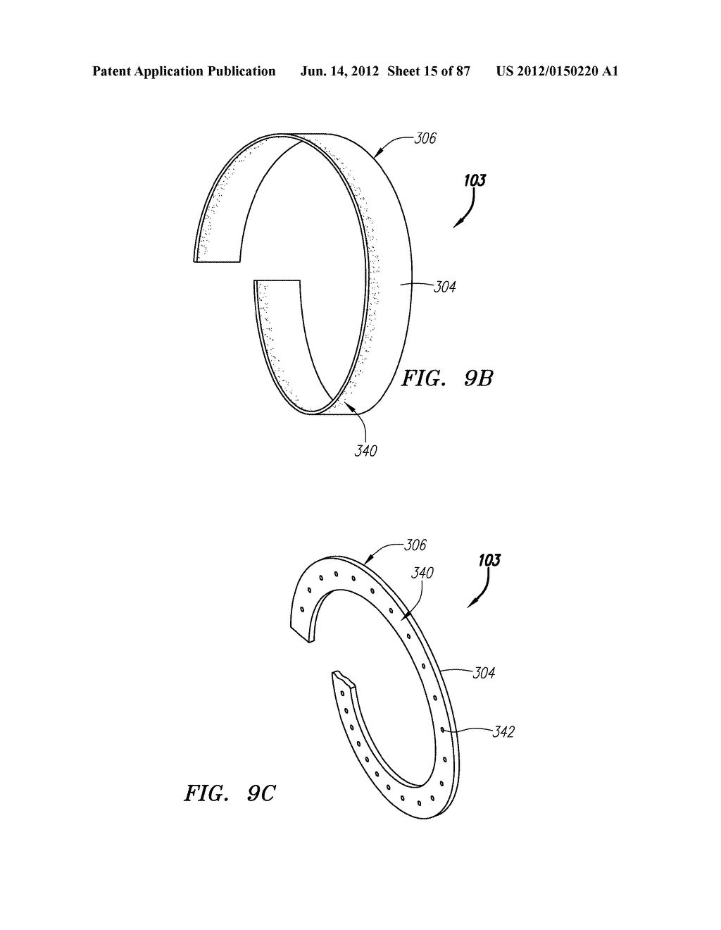 Systems and Methods for Treating Septal Defects - diagram, schematic, and image 16