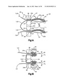 STITCH LOCK FOR ATTACHING TWO OR MORE STRUCTURES diagram and image