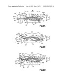 STITCH LOCK FOR ATTACHING TWO OR MORE STRUCTURES diagram and image