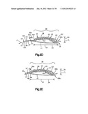 STITCH LOCK FOR ATTACHING TWO OR MORE STRUCTURES diagram and image