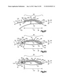 STITCH LOCK FOR ATTACHING TWO OR MORE STRUCTURES diagram and image