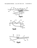 STITCH LOCK FOR ATTACHING TWO OR MORE STRUCTURES diagram and image