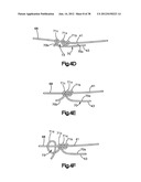 STITCH LOCK FOR ATTACHING TWO OR MORE STRUCTURES diagram and image