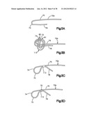 STITCH LOCK FOR ATTACHING TWO OR MORE STRUCTURES diagram and image