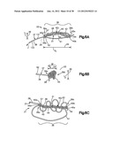 STITCH LOCK FOR ATTACHING TWO OR MORE STRUCTURES diagram and image