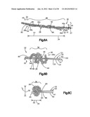 STITCH LOCK FOR ATTACHING TWO OR MORE STRUCTURES diagram and image