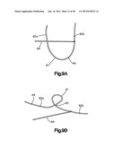 STITCH LOCK FOR ATTACHING TWO OR MORE STRUCTURES diagram and image