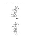 STITCH LOCK FOR ATTACHING TWO OR MORE STRUCTURES diagram and image