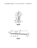 STITCH LOCK FOR ATTACHING TWO OR MORE STRUCTURES diagram and image