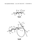 STITCH LOCK FOR ATTACHING TWO OR MORE STRUCTURES diagram and image