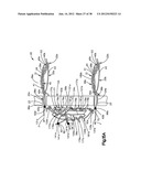 STITCH LOCK FOR ATTACHING TWO OR MORE STRUCTURES diagram and image