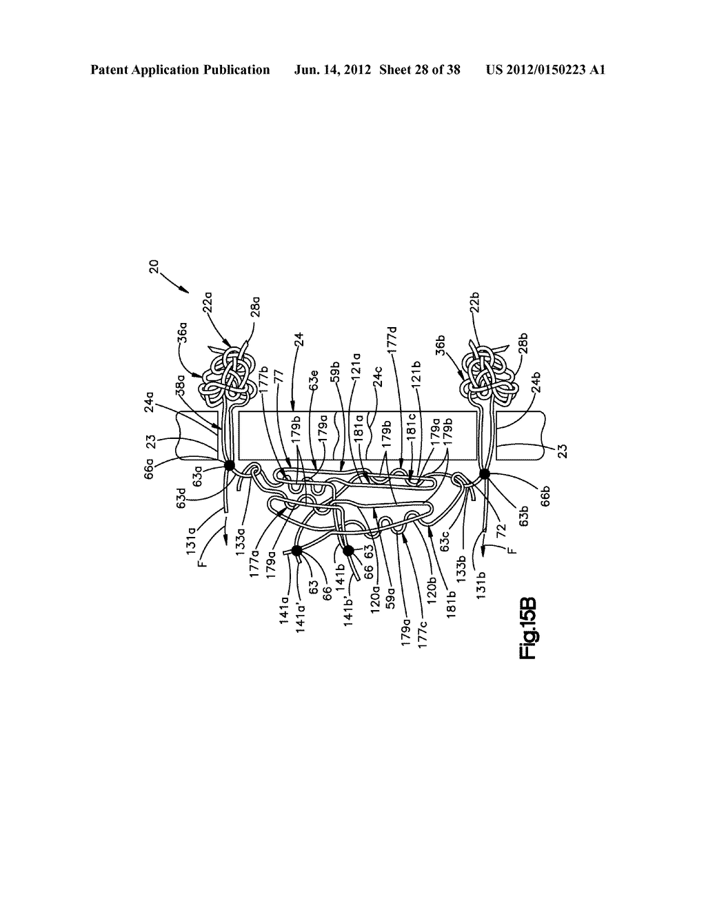 STITCH LOCK FOR ATTACHING TWO OR MORE STRUCTURES - diagram, schematic, and image 29