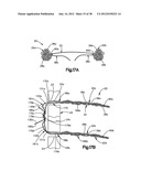 STITCH LOCK FOR ATTACHING TWO OR MORE STRUCTURES diagram and image