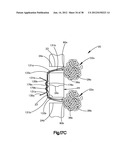 STITCH LOCK FOR ATTACHING TWO OR MORE STRUCTURES diagram and image