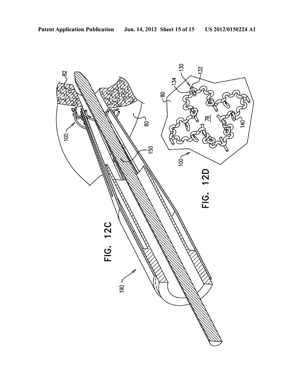 SURGICAL TECHNIQUES AND CLOSURE DEVICES FOR DIRECT CARDIAC CATHETERIZATION - diagram, schematic, and image 16