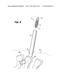 INTERSPINOUS PROCESS IMPLANTS HAVING DEPLOYABLE ENGAGEMENT ARMS diagram and image