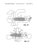 INTERSPINOUS PROCESS IMPLANTS HAVING DEPLOYABLE ENGAGEMENT ARMS diagram and image