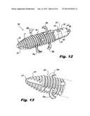 INTERSPINOUS PROCESS IMPLANTS HAVING DEPLOYABLE ENGAGEMENT ARMS diagram and image