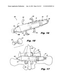 INTERSPINOUS PROCESS IMPLANTS HAVING DEPLOYABLE ENGAGEMENT ARMS diagram and image