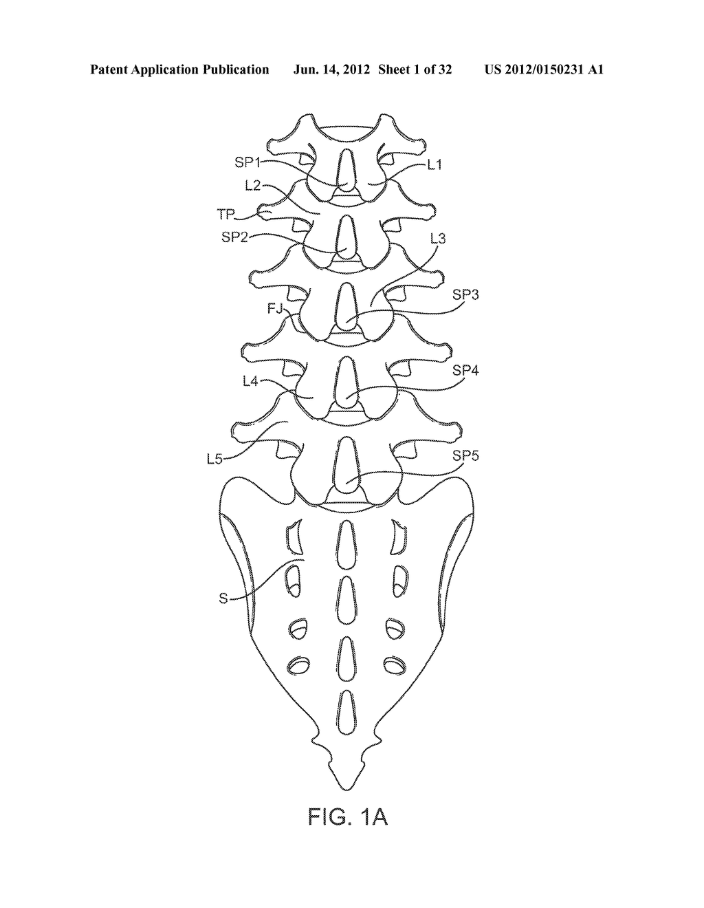 SACRAL TETHER ANCHOR AND METHODS OF USE - diagram, schematic, and image 02