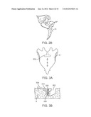 SACRAL TETHER ANCHOR AND METHODS OF USE diagram and image