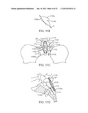 SACRAL TETHER ANCHOR AND METHODS OF USE diagram and image