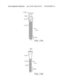 SACRAL TETHER ANCHOR AND METHODS OF USE diagram and image