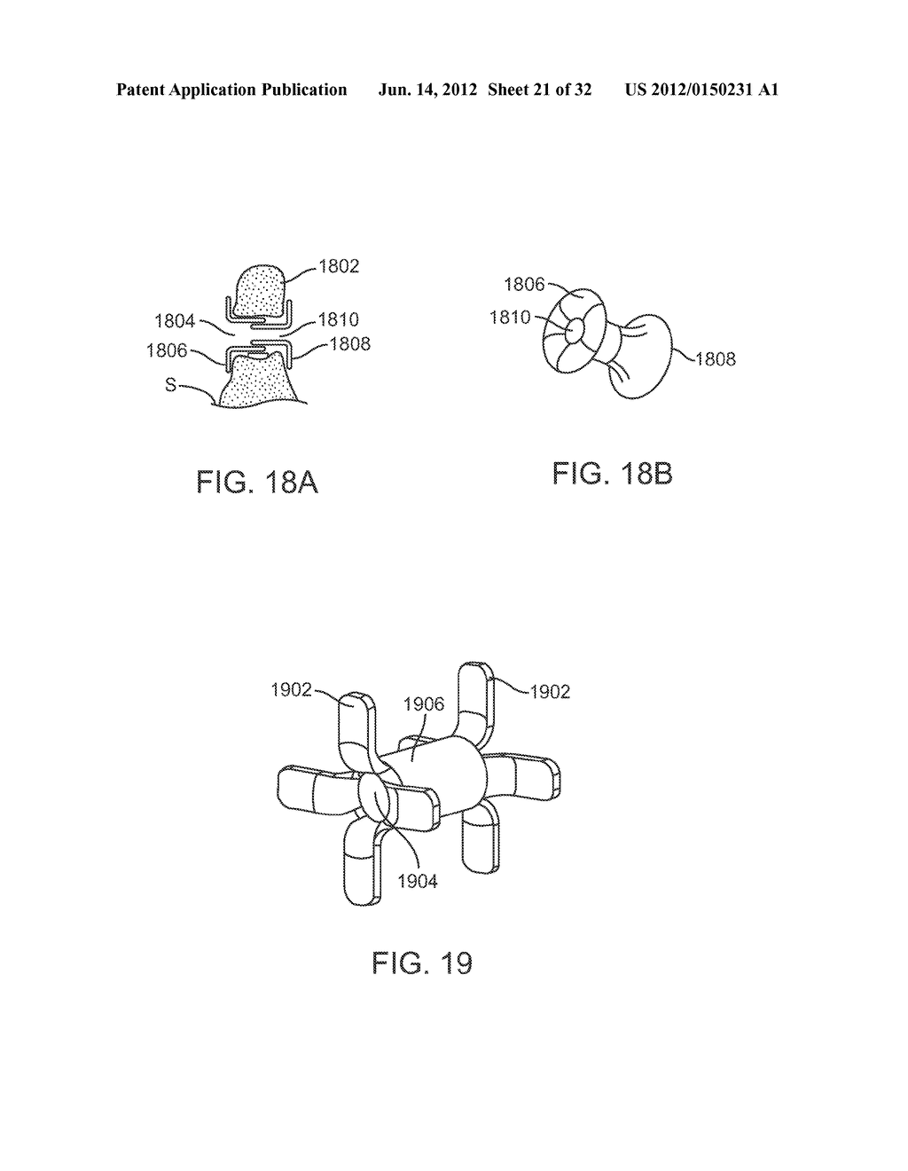 SACRAL TETHER ANCHOR AND METHODS OF USE - diagram, schematic, and image 22