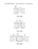 SACRAL TETHER ANCHOR AND METHODS OF USE diagram and image