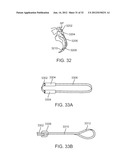 SACRAL TETHER ANCHOR AND METHODS OF USE diagram and image