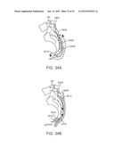 SACRAL TETHER ANCHOR AND METHODS OF USE diagram and image