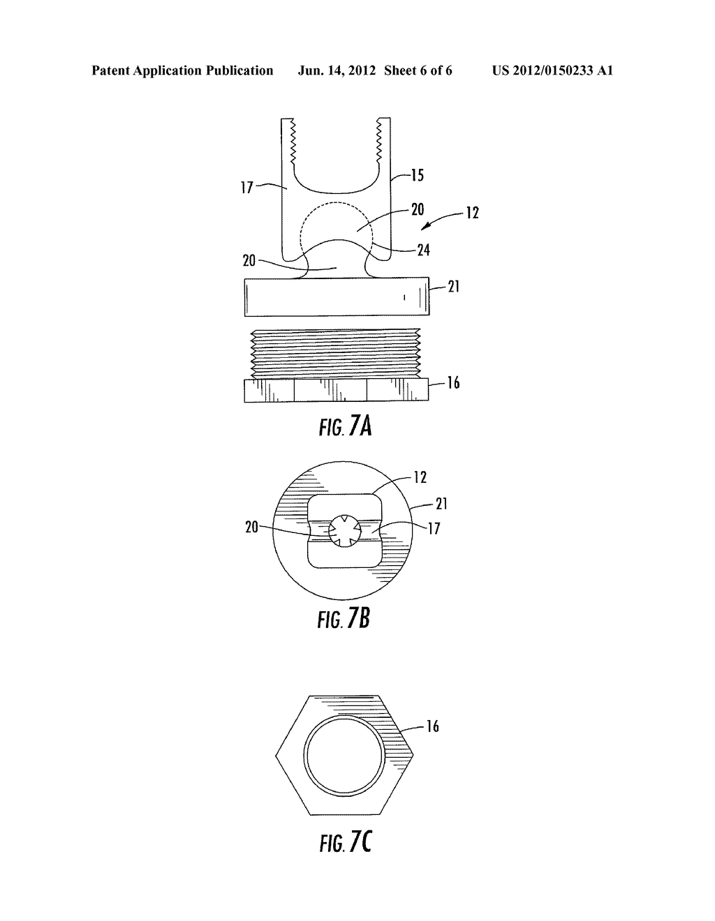 Modular Pedicle Screw System - diagram, schematic, and image 07