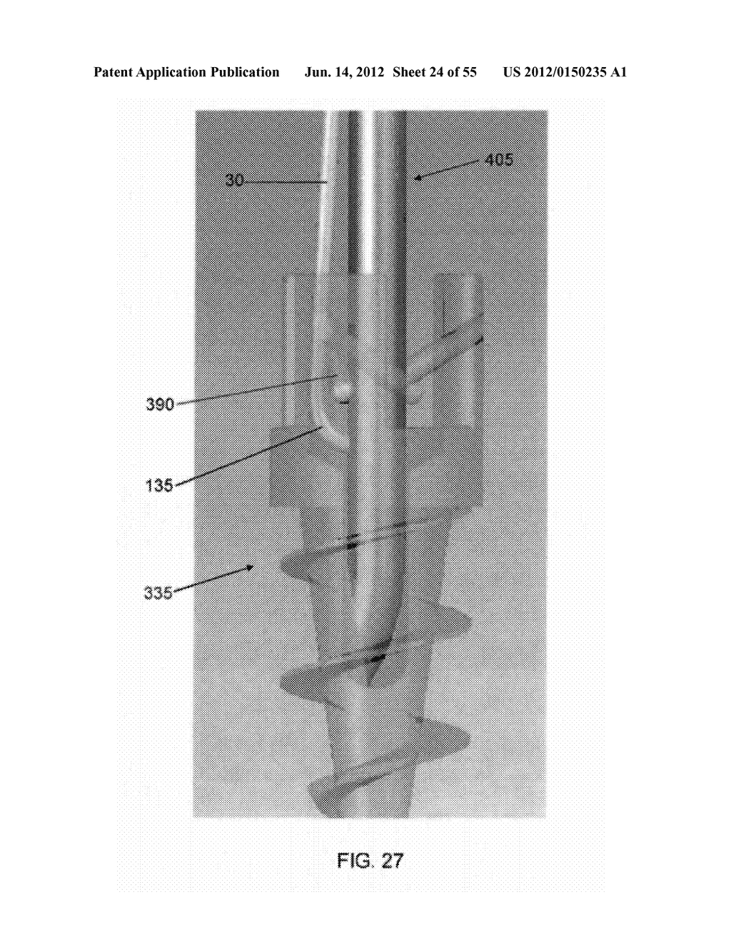 METHOD AND APPARATUS FOR ATTACHING SOFT TISSUE TO BONE - diagram, schematic, and image 25