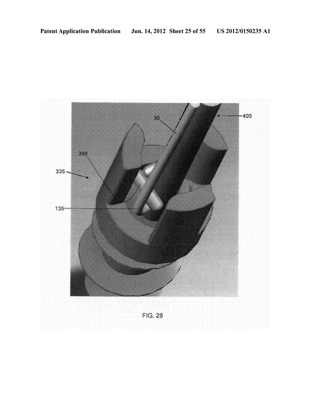 METHOD AND APPARATUS FOR ATTACHING SOFT TISSUE TO BONE - diagram, schematic, and image 26