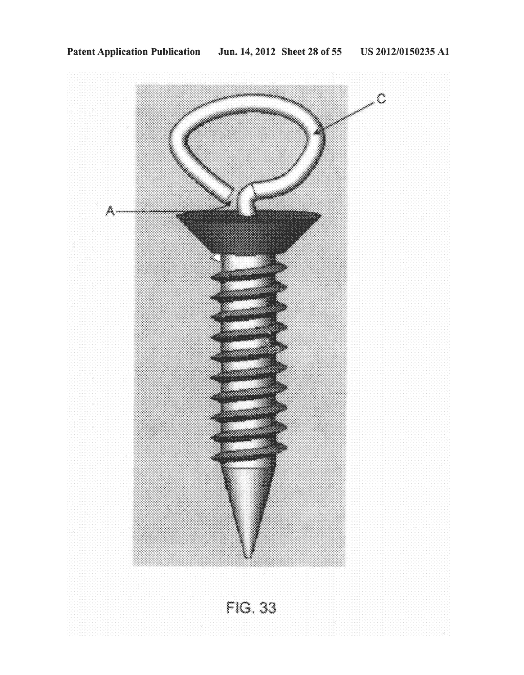 METHOD AND APPARATUS FOR ATTACHING SOFT TISSUE TO BONE - diagram, schematic, and image 29