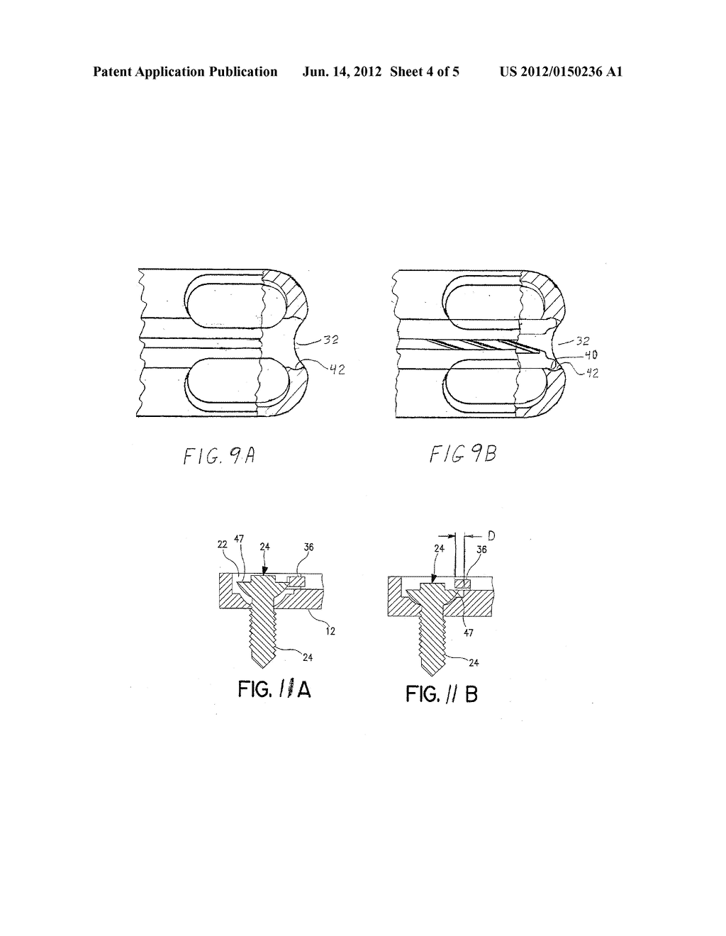 BONE REPAIR SYSTEMS - diagram, schematic, and image 05