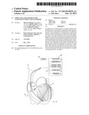 Admittance measurement for tuning bi-ventricular pacemakers diagram and image