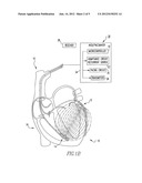 Admittance measurement for tuning bi-ventricular pacemakers diagram and image