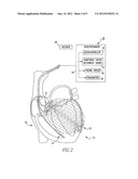 Admittance measurement for tuning bi-ventricular pacemakers diagram and image