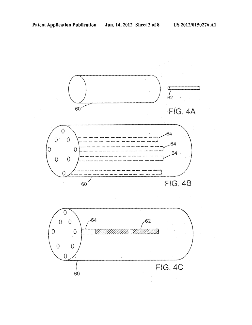 MEDICAL DEVICES AND METHOD FOR MAKING THE SAME - diagram, schematic, and image 04