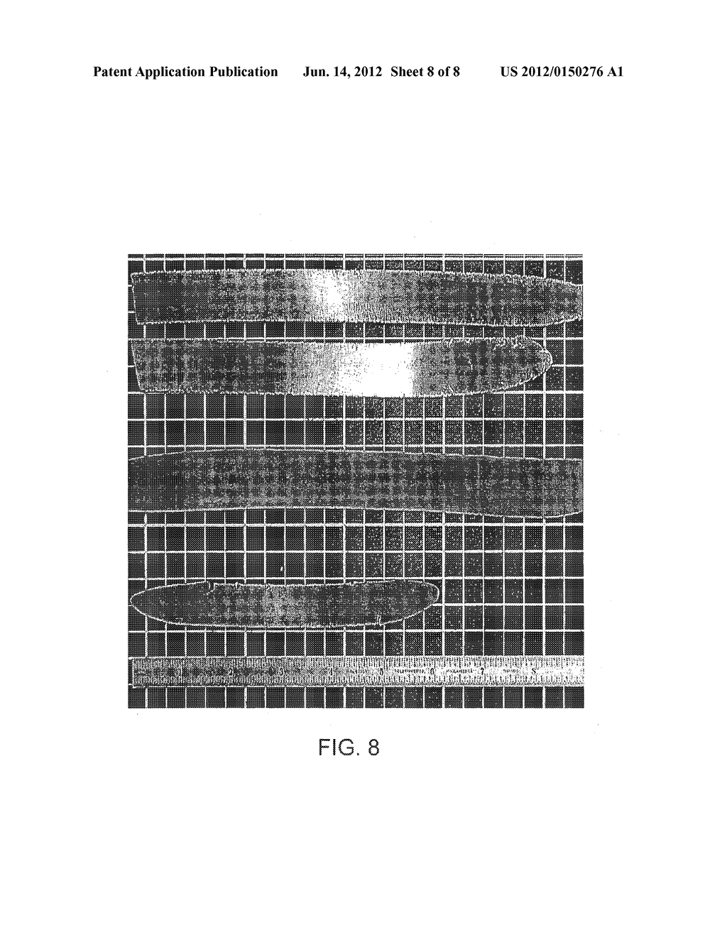 MEDICAL DEVICES AND METHOD FOR MAKING THE SAME - diagram, schematic, and image 09