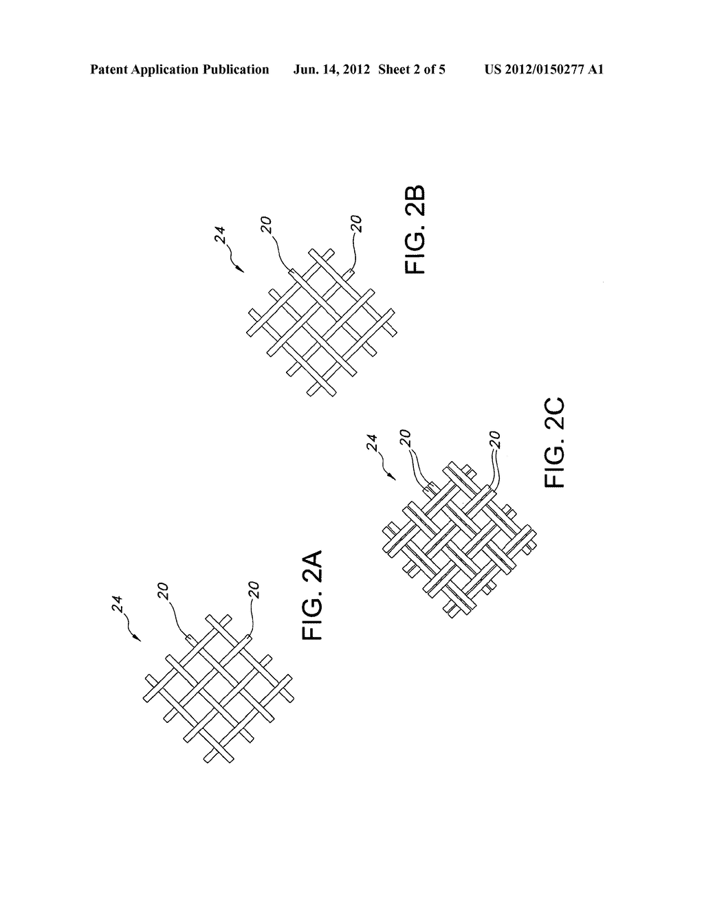 CONTINUOUS DOUBLE LAYERED STENT FOR MIGRATION RESISTANCE - diagram, schematic, and image 03