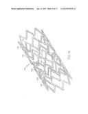 LONGITUDINALLY FLEXIBLE EXPANDABLE STENT diagram and image