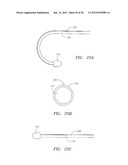 Methods and Devices for Delivery of Prosthetic Heart Valves and Other     Prosthesis diagram and image