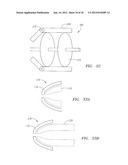 Methods and Devices for Delivery of Prosthetic Heart Valves and Other     Prosthesis diagram and image