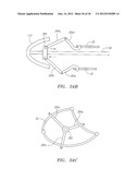 Methods and Devices for Delivery of Prosthetic Heart Valves and Other     Prosthesis diagram and image