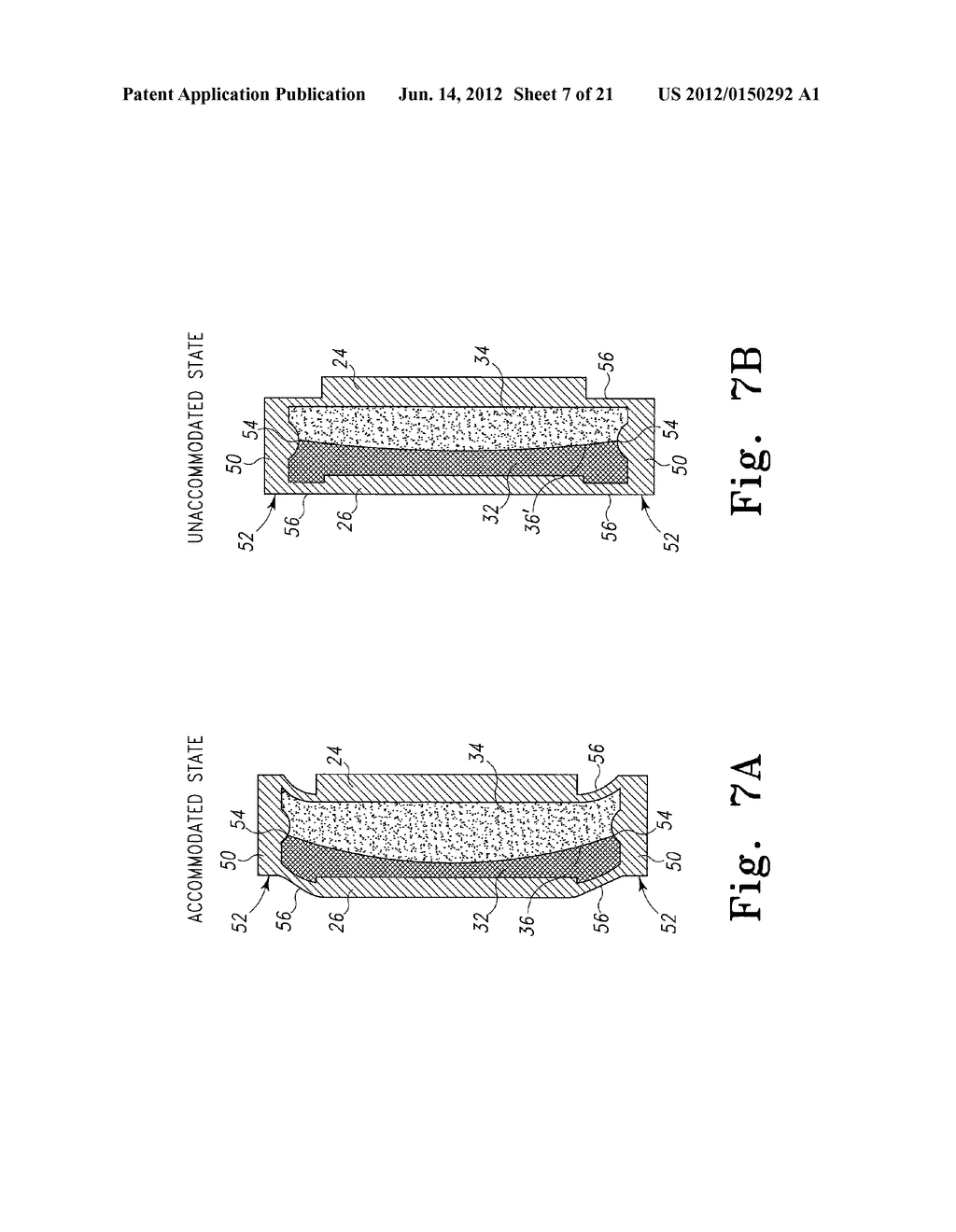 INTERFACIAL REFRACTION ACCOMMODATING LENS (IRAL) - diagram, schematic, and image 08