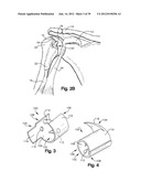 SOFT TISSUE REPAIR APPARATUS AND METHOD diagram and image